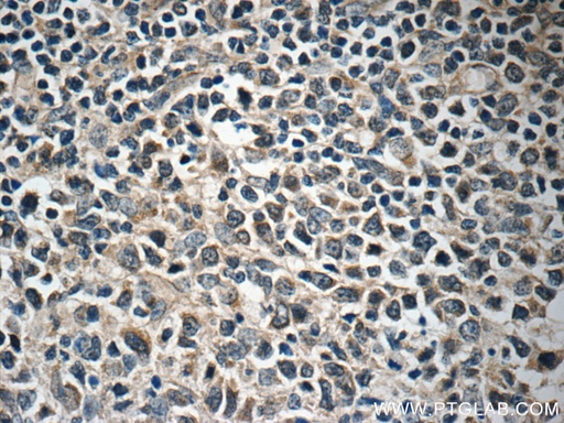 [11556-1-AP-150UL] FBXL18 Polyclonal antibody