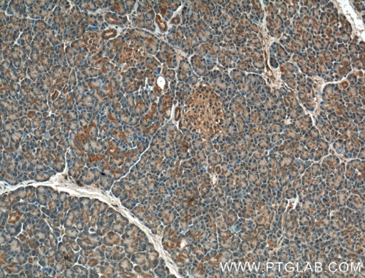 [11557-1-AP-150UL] GTPBP2 Polyclonal antibody