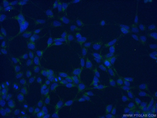[11559-1-AP-150UL] AGTRAP Polyclonal antibody