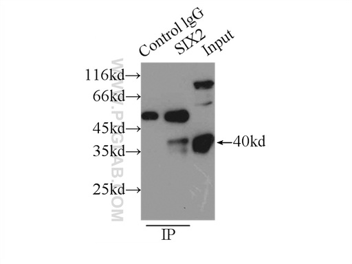 [11562-1-AP-150UL] SIX2 Polyclonal antibody