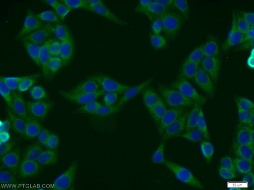 [11564-1-AP-150UL] BMSC UbP Polyclonal antibody