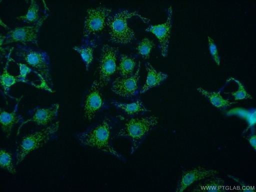[11566-1-AP-150UL] MED15 Polyclonal antibody