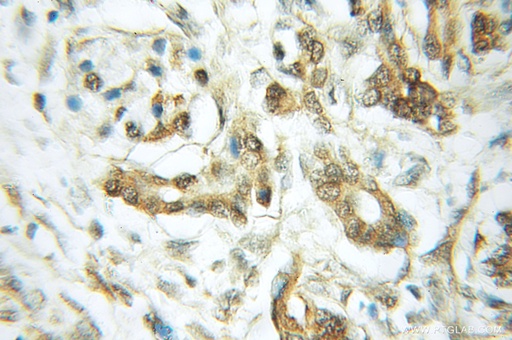 [11569-1-AP-20UL] RASEF Polyclonal antibody