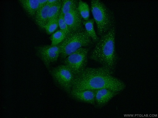 [11571-1-AP-150UL] TRK fused gene Polyclonal antibody