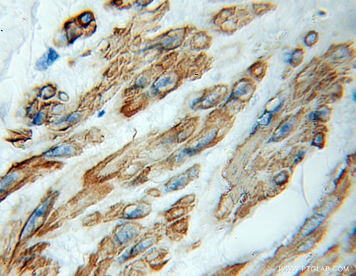 [11572-1-AP-20UL] kazrin Polyclonal antibody