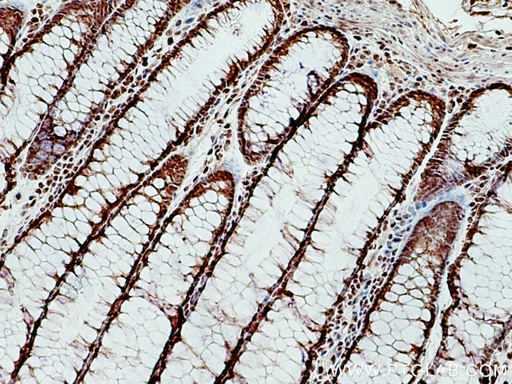 [11576-2-AP-20UL] OGT Polyclonal antibody
