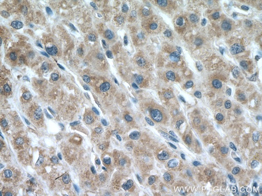 [11577-1-AP-20UL] LIAS Polyclonal antibody
