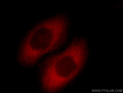[11579-1-AP-20UL] SCIN Polyclonal antibody