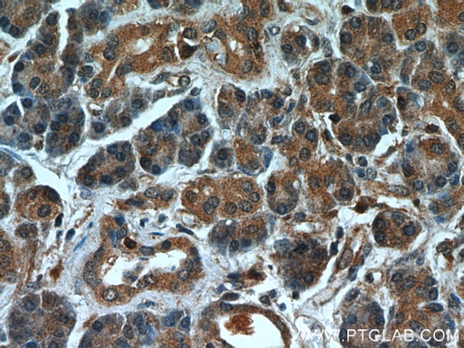 [11581-1-AP-20UL] MTRF1 Polyclonal antibody