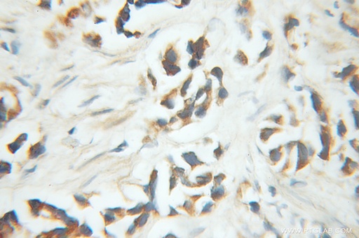 [11584-1-AP-150UL] PNKD Polyclonal antibody