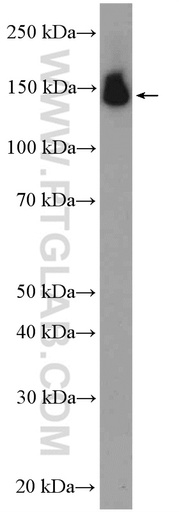 [11586-1-AP-150UL] PUM2 Polyclonal antibody