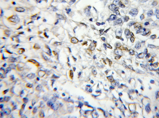[11588-1-AP-20UL] RABL2B Polyclonal antibody