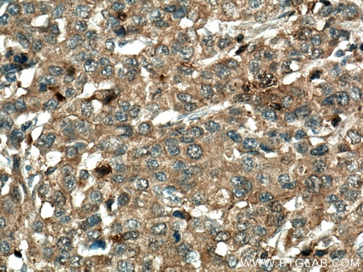 [11590-1-AP-150UL] RGS5 Polyclonal antibody