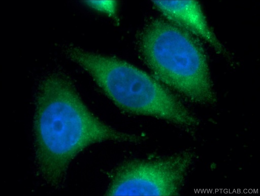 [11597-1-AP-150UL] IFI30 Polyclonal antibody