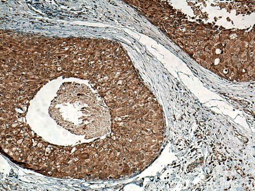 [11599-1-AP-20UL] SURF4 Polyclonal antibody