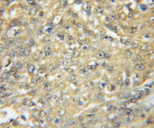 [11600-1-AP-150UL] HCK Polyclonal antibody