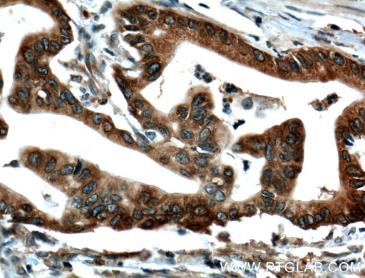 [11601-1-AP-20UL] IGF2BP2 Polyclonal antibody