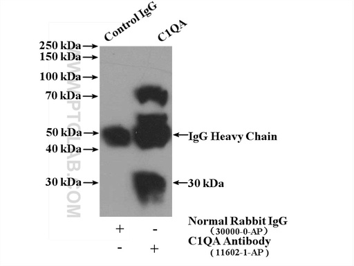 [11602-1-AP-150UL] C1qA Polyclonal antibody