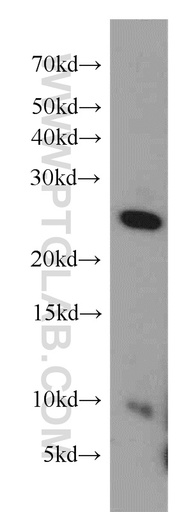 [11605-1-AP-20UL] FGFR1OP2 Polyclonal antibody