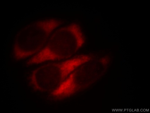 [11610-1-AP-20UL] MTX2 Polyclonal antibody