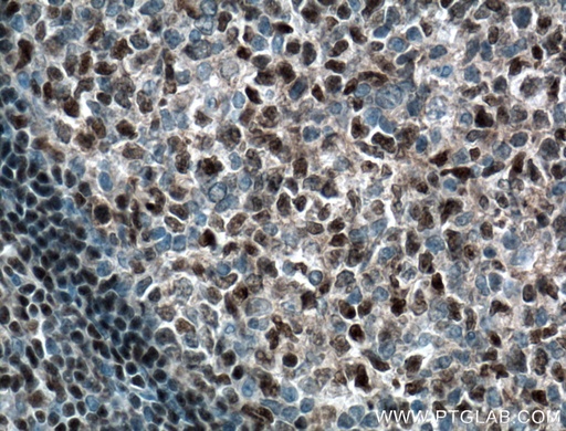 [11613-1-AP-20UL] BCL11A Polyclonal antibody