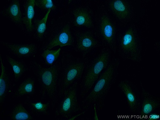 [11614-1-AP-150UL] RBM4 Polyclonal antibody
