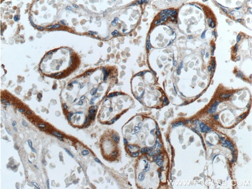 [11615-1-AP-20UL] hCG Beta Polyclonal antibody