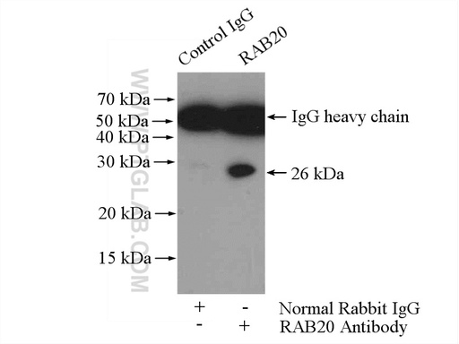 [11616-1-AP-150UL] RAB20 Polyclonal antibody