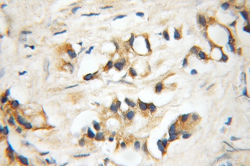 [11617-1-AP-20UL] DDX28 Polyclonal antibody
