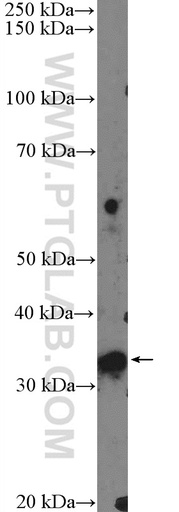 [11620-1-AP-150UL] FTSJ1 Polyclonal antibody