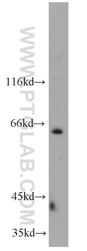 [11621-1-AP-150UL] NEIL3 Polyclonal antibody
