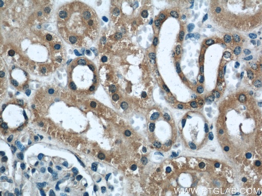 [11622-1-AP-20UL] DOCK8 Polyclonal antibody