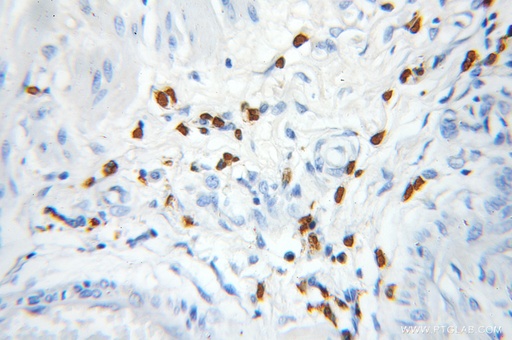[11623-1-AP-150UL] PRKD2 Polyclonal antibody