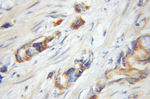 [11624-1-AP-150UL] UHMK1 Polyclonal antibody