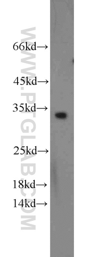 [11625-1-AP-150UL] CDCA4 Polyclonal antibody