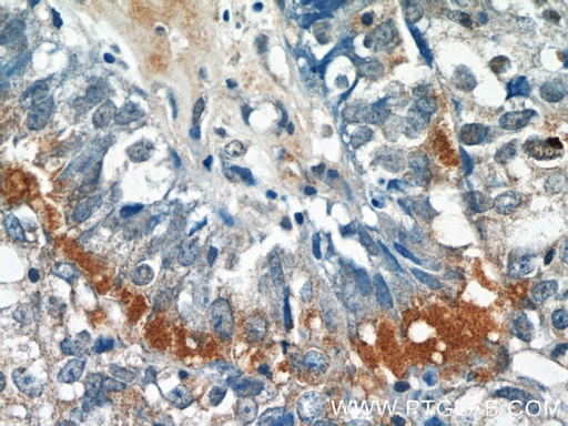 [11627-1-AP-150UL] EPSTI1 Polyclonal antibody
