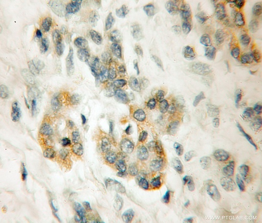 [11628-1-AP-20UL] LRR 1 Polyclonal antibody