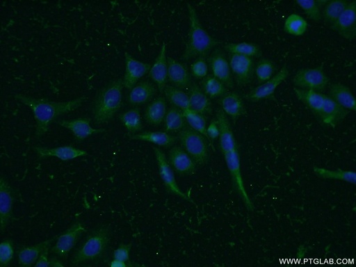 [11630-1-AP-150UL] MIG6; ERRFI1 Polyclonal antibody