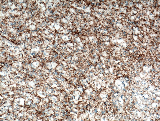 [11631-1-AP-20UL] SEPT5 Polyclonal antibody