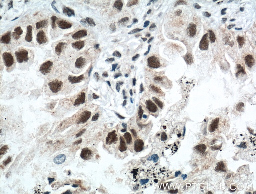 [11633-1-AP-150UL] ZMYND8 Polyclonal antibody