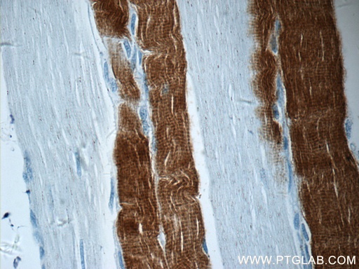 [11634-1-AP-150UL] TNNI2 Polyclonal antibody