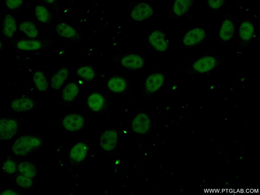 [11637-1-AP-150UL] DNTTIP1 Polyclonal antibody