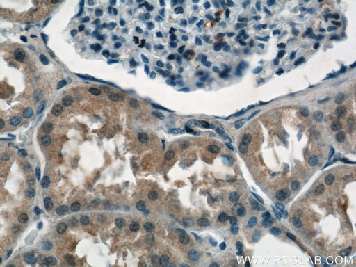 [11638-1-AP-150UL] NPLOC4 Polyclonal antibody