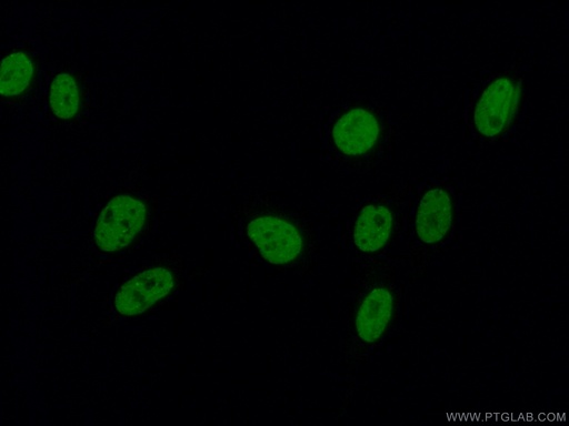 [11642-1-AP-150UL] SAFB2 Polyclonal antibody