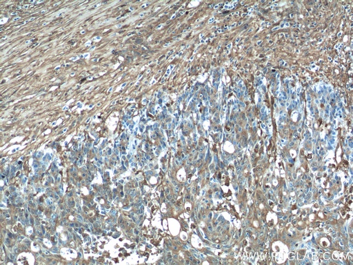 [11644-2-AP-20UL] Gelsolin Polyclonal antibody