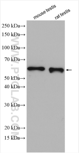 [11645-1-AP-150UL] KLC3 Polyclonal antibody
