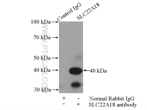 [11646-2-AP-150UL] SLC22A18 Polyclonal antibody