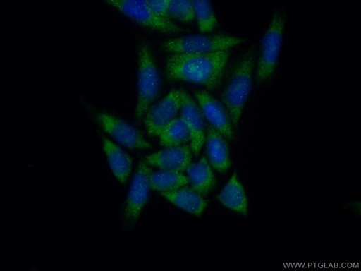[11649-2-AP-20UL] EIF1AX Polyclonal antibody