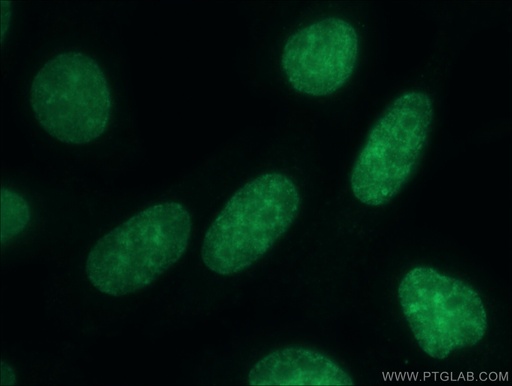 [11650-2-AP-20UL] CBX3 Polyclonal antibody