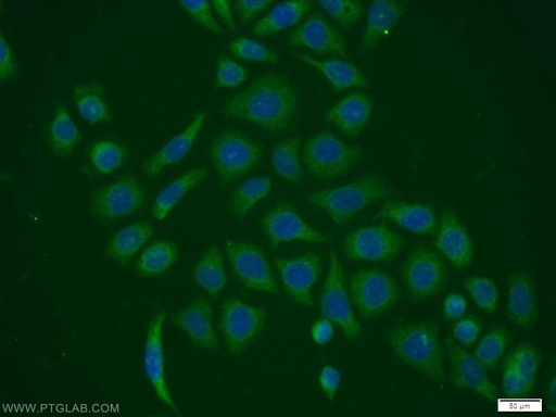 [11651-1-AP-150UL] PPIH Polyclonal antibody
